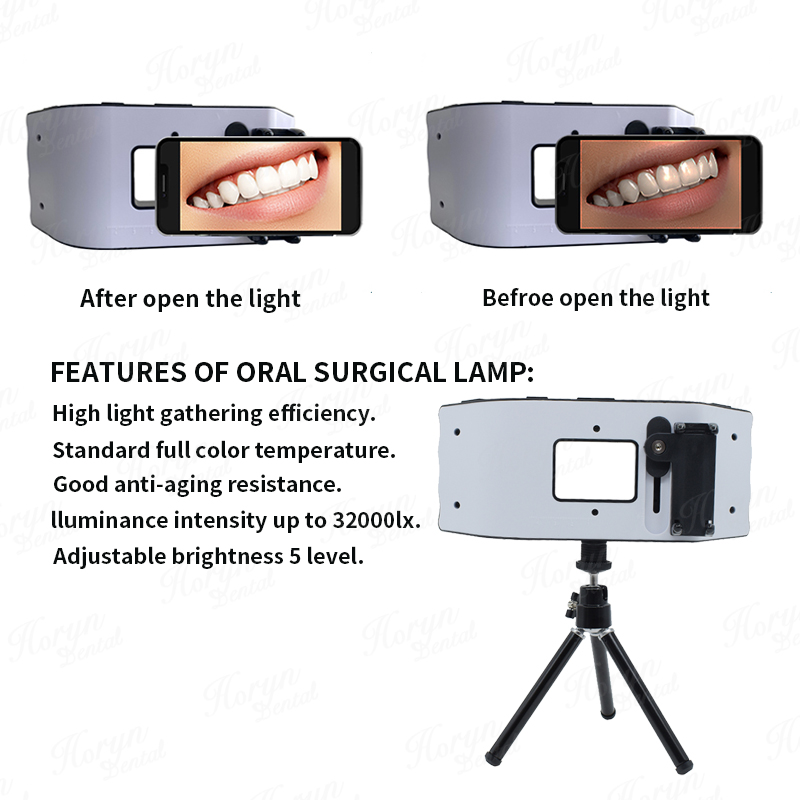 Dental Blitzlicht Fotografie A – Photography Lighting With Flash Bewertung und Preis